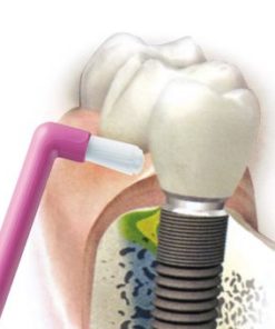 Alternative view of CURAPROX CS 1009 - single četkica za zube a 1, Za čišćenje svakog pojedinog zuba zasebno i ruba desni