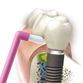 CURAPROX CS 1009 - single četkica za zube a 1, Za čišćenje svakog pojedinog zuba zasebno i ruba desni - Image 2